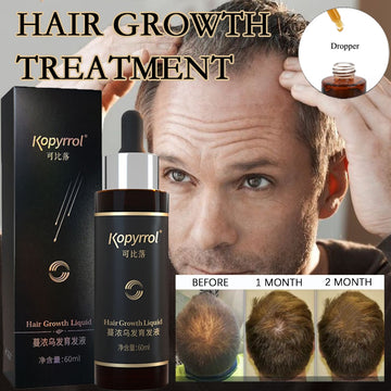 60ml Hair Growth Essence Dense Hair Growth Serum for Men/Women Hair Loss Treatment Scalp Care Ginger Germinal Regrowth Hair Oils